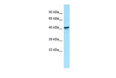 Western Blot: KIR2DL5B Antibody [NBP3-09480] - WB Suggested Anti-KIR2DL5B Antibody. Titration: 1.0 ug/ml. Positive Control: Fetal kidney